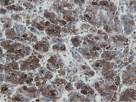 MIPEP Antibody in Immunohistochemistry (Paraffin) (IHC (P))