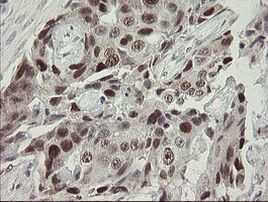 RFC2 Antibody in Immunohistochemistry (Paraffin) (IHC (P))