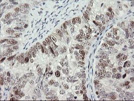 RFC2 Antibody in Immunohistochemistry (Paraffin) (IHC (P))