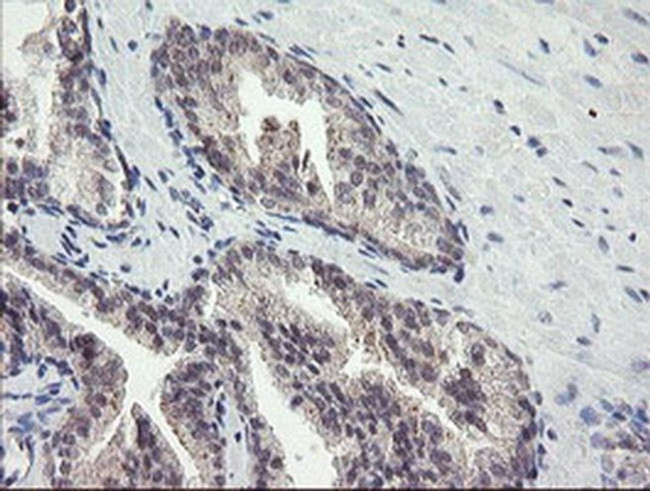 FBXO42 Antibody in Immunohistochemistry (Paraffin) (IHC (P))