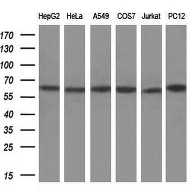 METAP2 Antibody in Western Blot (WB)