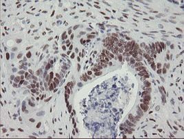 TLE1 Antibody in Immunohistochemistry (Paraffin) (IHC (P))