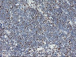 TLE1 Antibody in Immunohistochemistry (Paraffin) (IHC (P))