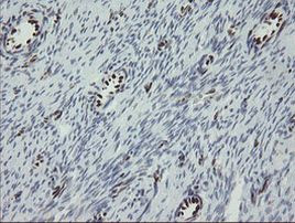 TLE1 Antibody in Immunohistochemistry (Paraffin) (IHC (P))