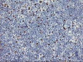 TLE1 Antibody in Immunohistochemistry (Paraffin) (IHC (P))