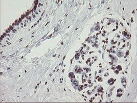 TLE1 Antibody in Immunohistochemistry (Paraffin) (IHC (P))