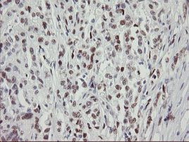 TLE1 Antibody in Immunohistochemistry (Paraffin) (IHC (P))