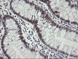 TLE1 Antibody in Immunohistochemistry (Paraffin) (IHC (P))