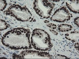 TLE1 Antibody in Immunohistochemistry (Paraffin) (IHC (P))