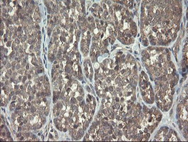 ARL2BP Antibody in Immunohistochemistry (Paraffin) (IHC (P))