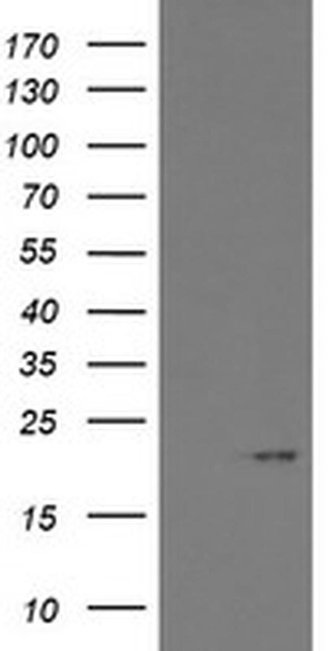 ARL2BP Antibody in Western Blot (WB)