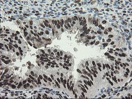 TLE1 Antibody in Immunohistochemistry (Paraffin) (IHC (P))