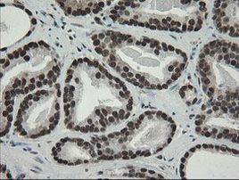 TLE1 Antibody in Immunohistochemistry (Paraffin) (IHC (P))