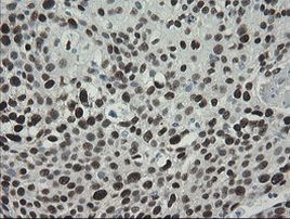 TLE1 Antibody in Immunohistochemistry (Paraffin) (IHC (P))