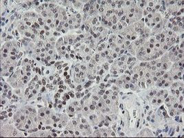 TLE1 Antibody in Immunohistochemistry (Paraffin) (IHC (P))