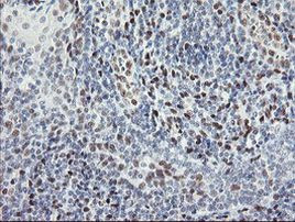 TLE1 Antibody in Immunohistochemistry (Paraffin) (IHC (P))