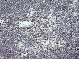 TLE1 Antibody in Immunohistochemistry (Paraffin) (IHC (P))