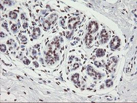 TLE1 Antibody in Immunohistochemistry (Paraffin) (IHC (P))