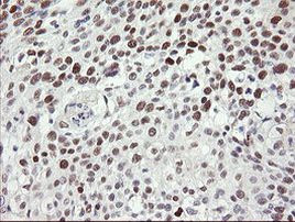 TLE1 Antibody in Immunohistochemistry (Paraffin) (IHC (P))