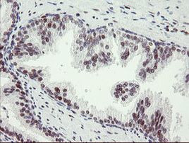 TLE1 Antibody in Immunohistochemistry (Paraffin) (IHC (P))