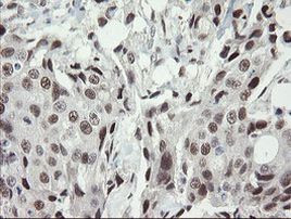 TLE1 Antibody in Immunohistochemistry (Paraffin) (IHC (P))