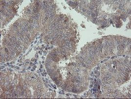 RIP1 Antibody in Immunohistochemistry (Paraffin) (IHC (P))