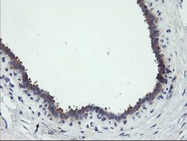 RIP1 Antibody in Immunohistochemistry (Paraffin) (IHC (P))