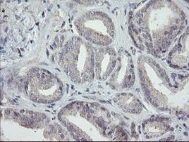 RIP1 Antibody in Immunohistochemistry (Paraffin) (IHC (P))