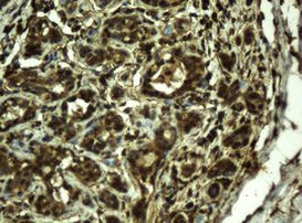 RIP1 Antibody in Immunohistochemistry (Paraffin) (IHC (P))