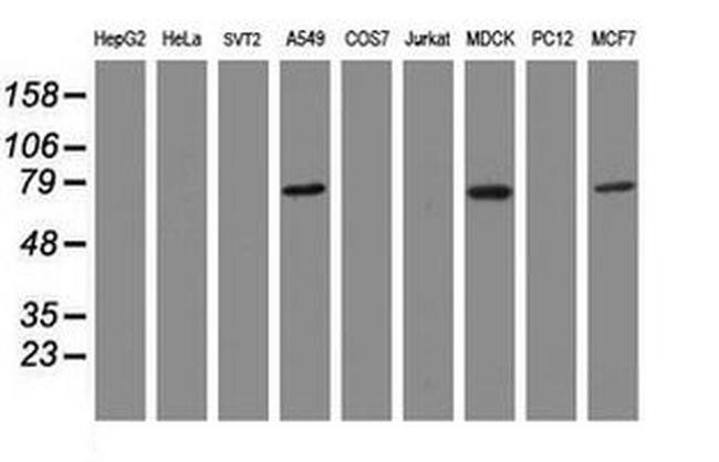 RIP1 Antibody in Western Blot (WB)