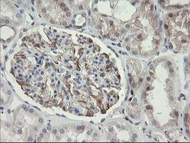 PHKG2 Antibody in Immunohistochemistry (Paraffin) (IHC (P))