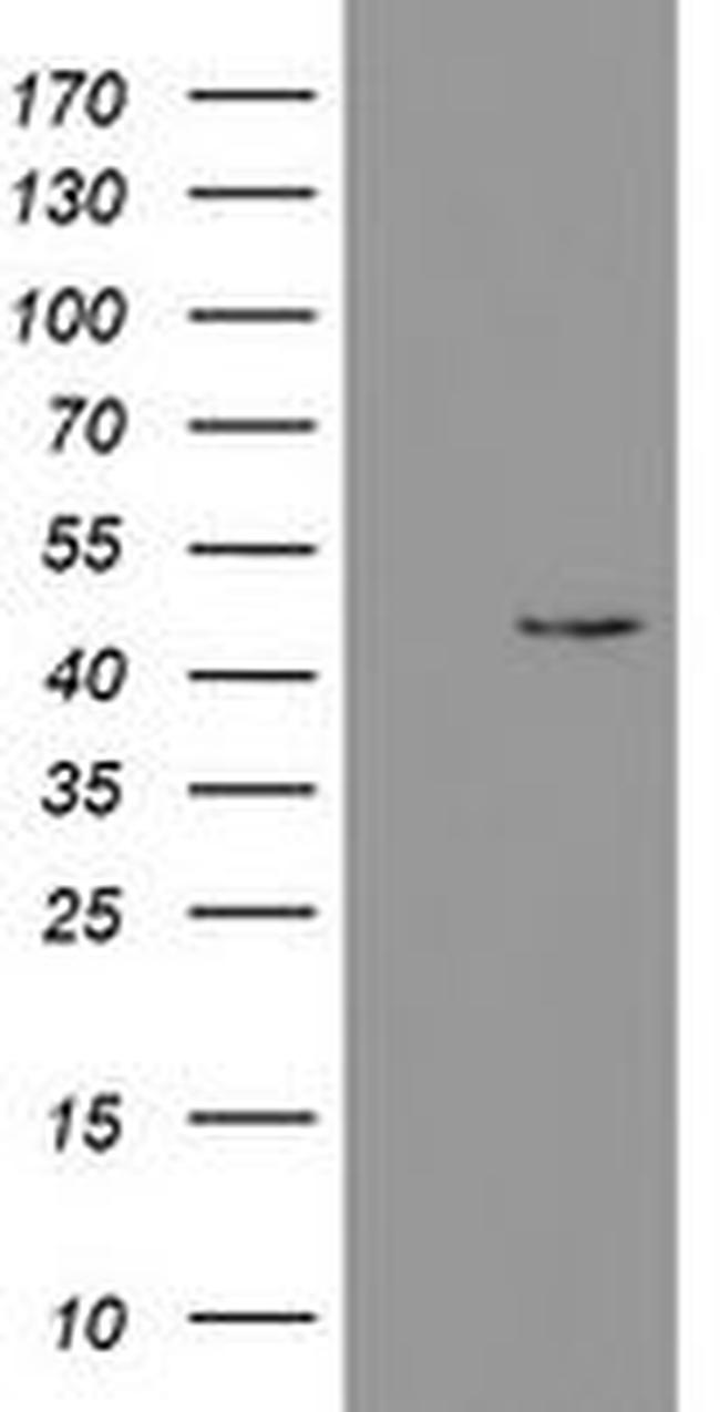 PHKG2 Antibody in Western Blot (WB)