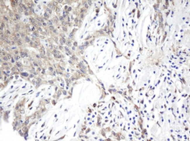 ARL2BP Antibody in Immunohistochemistry (Paraffin) (IHC (P))