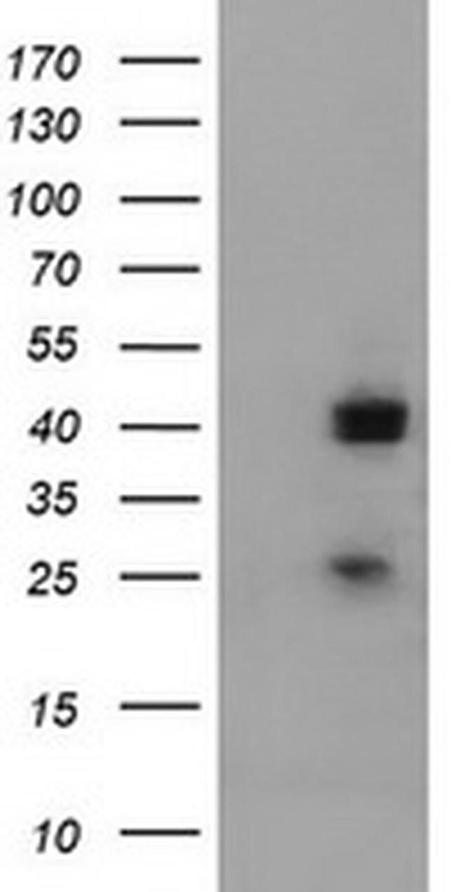 A4GNT Antibody in Western Blot (WB)