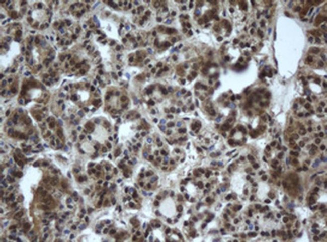 DDX59 Antibody in Immunohistochemistry (Paraffin) (IHC (P))