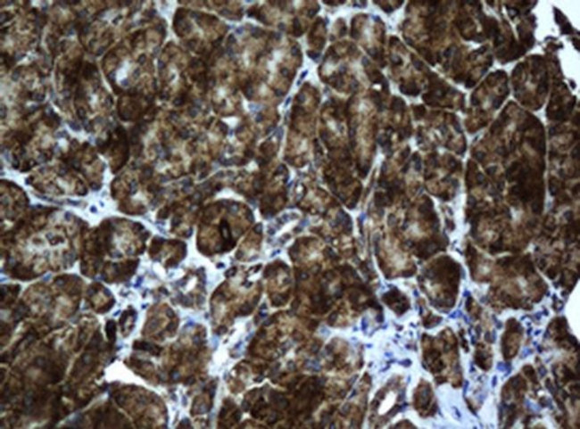 ACADS Antibody in Immunohistochemistry (Paraffin) (IHC (P))