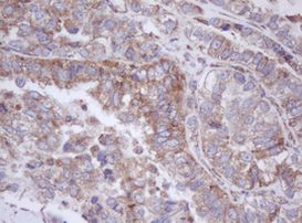 MTIF3 Antibody in Immunohistochemistry (Paraffin) (IHC (P))