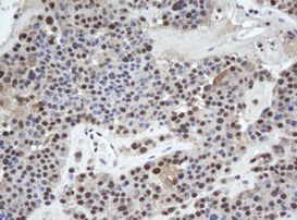 WDR74 Antibody in Immunohistochemistry (Paraffin) (IHC (P))