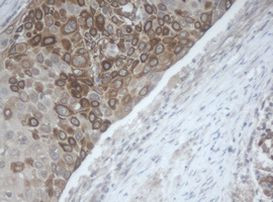 MAGEB1 Antibody in Immunohistochemistry (Paraffin) (IHC (P))