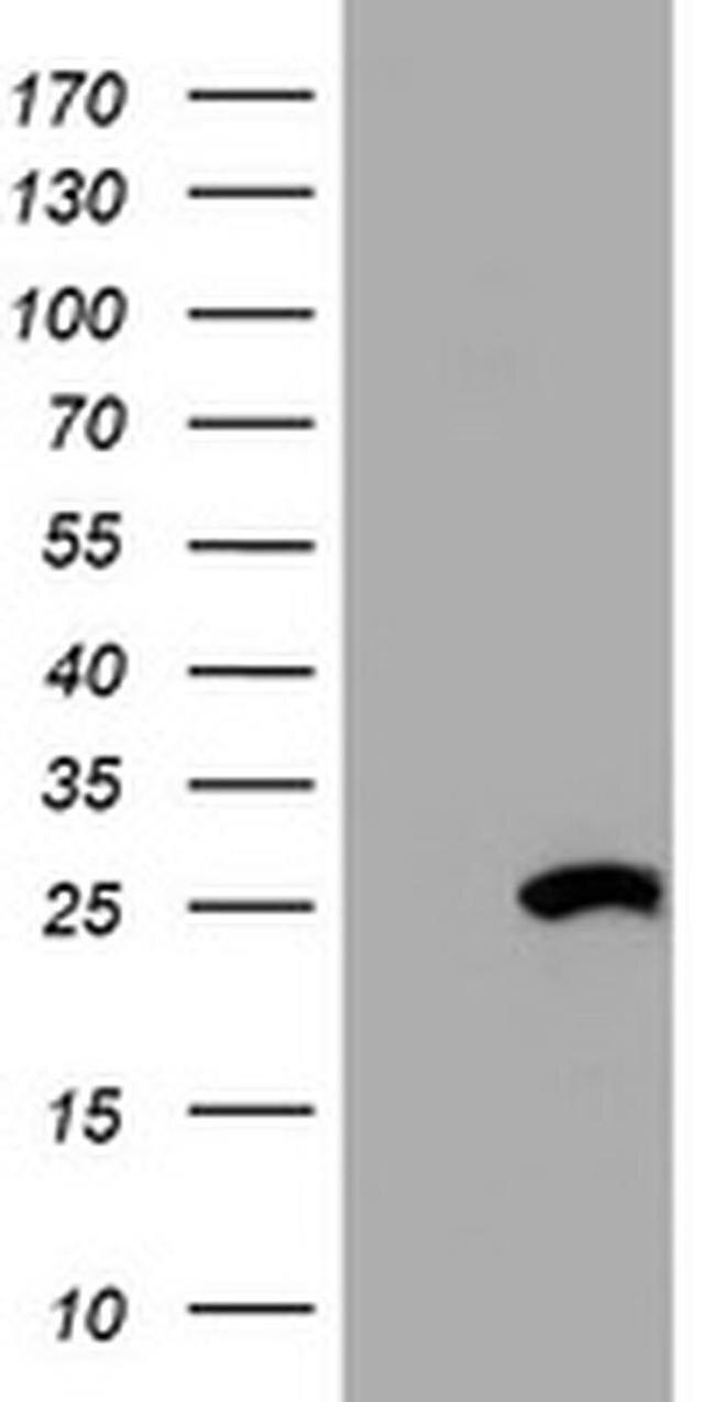 HSD17B8 Antibody in Western Blot (WB)