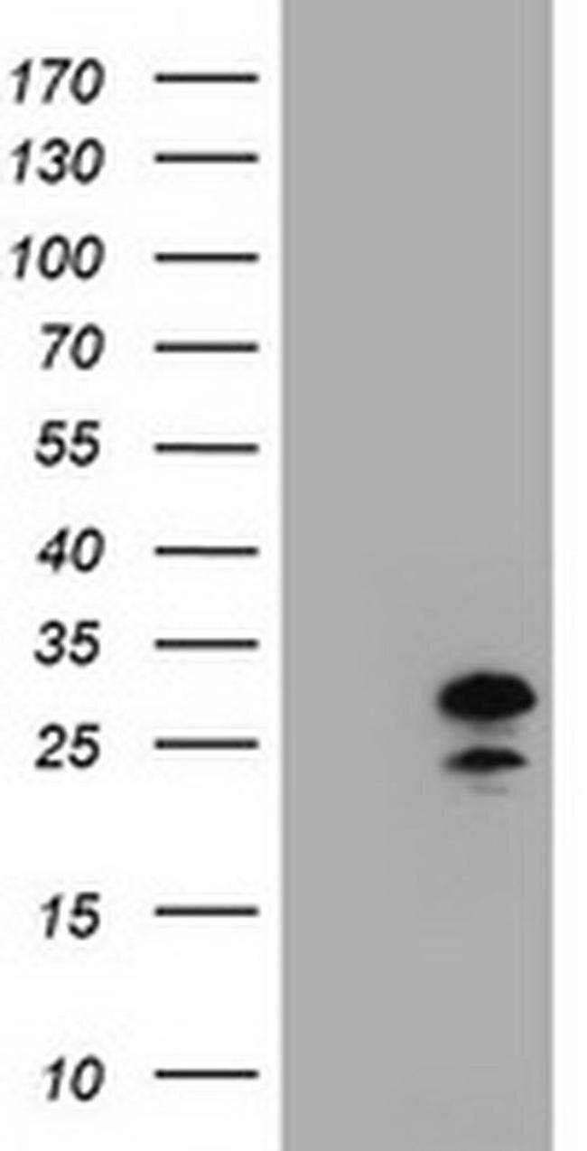 ZFAND5 Antibody in Western Blot (WB)