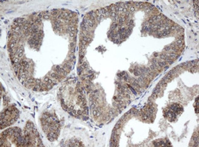 PPT1 Antibody in Immunohistochemistry (Paraffin) (IHC (P))