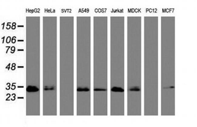 PPT1 Antibody in Western Blot (WB)