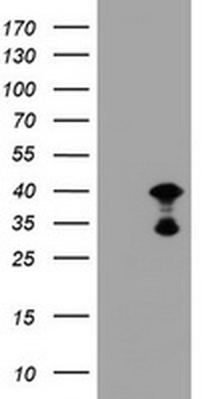 PRR11 Antibody in Western Blot (WB)