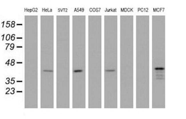 PRR11 Antibody in Western Blot (WB)