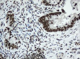 SF3A1 Antibody in Immunohistochemistry (Paraffin) (IHC (P))