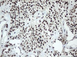 SF3A1 Antibody in Immunohistochemistry (Paraffin) (IHC (P))