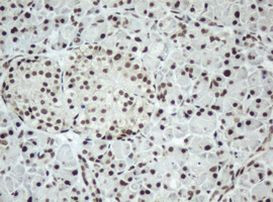 SF3A1 Antibody in Immunohistochemistry (Paraffin) (IHC (P))