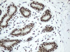 SF3A1 Antibody in Immunohistochemistry (Paraffin) (IHC (P))