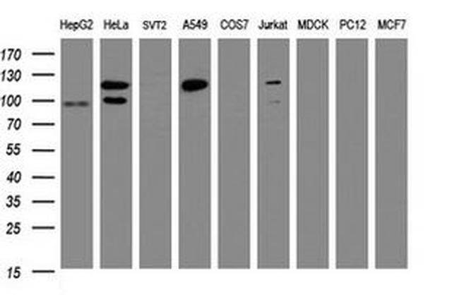 SF3A1 Antibody in Western Blot (WB)